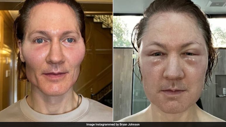 All About Bryan Johnson, Tech Millionaire Who Is Trying To ‘Reverse’ Ageing